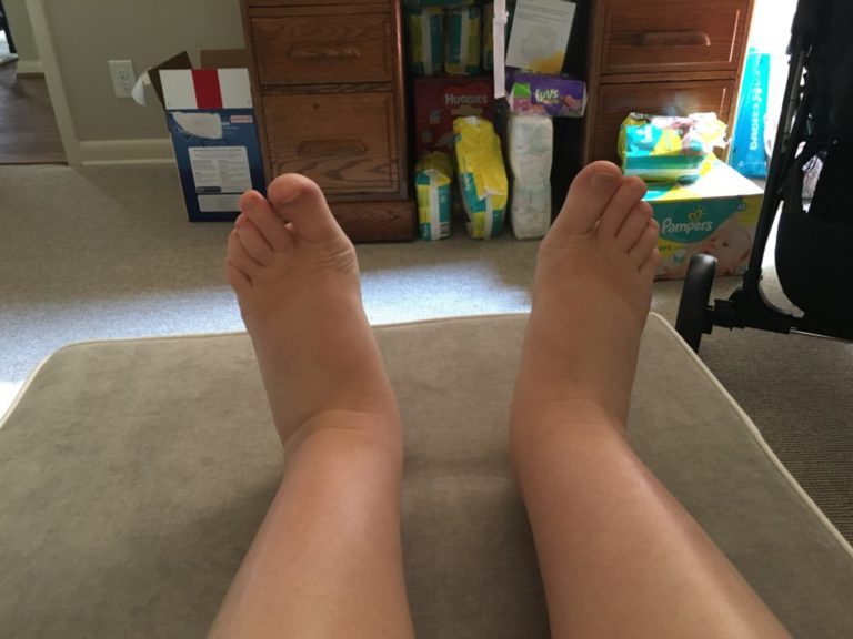 I didn't NEED anyone to tell me my feet were swollen, but tell me they did.
