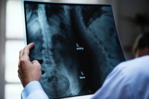 scoliosis diagnosis takes place using x-rays